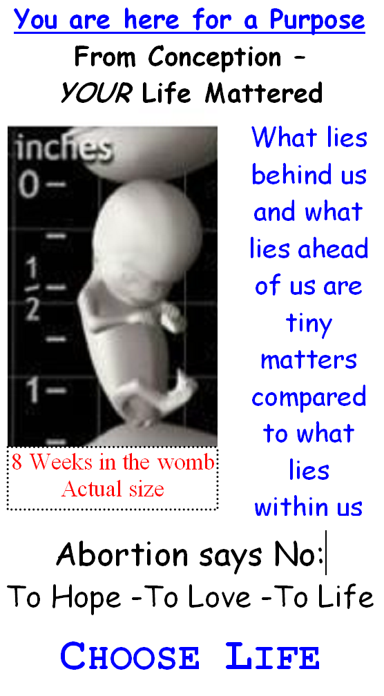A printed card headed “You are here for a Purpose — From Conception, YOUR Life Mattered,” showing a fetus at eight weeks photographed at actual size against a ruler, and ending “Choose Life.”